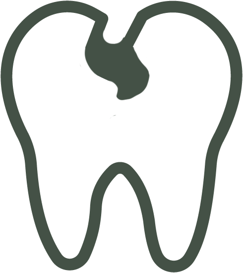 Cavity treatment at Dentology Dental Edmonton